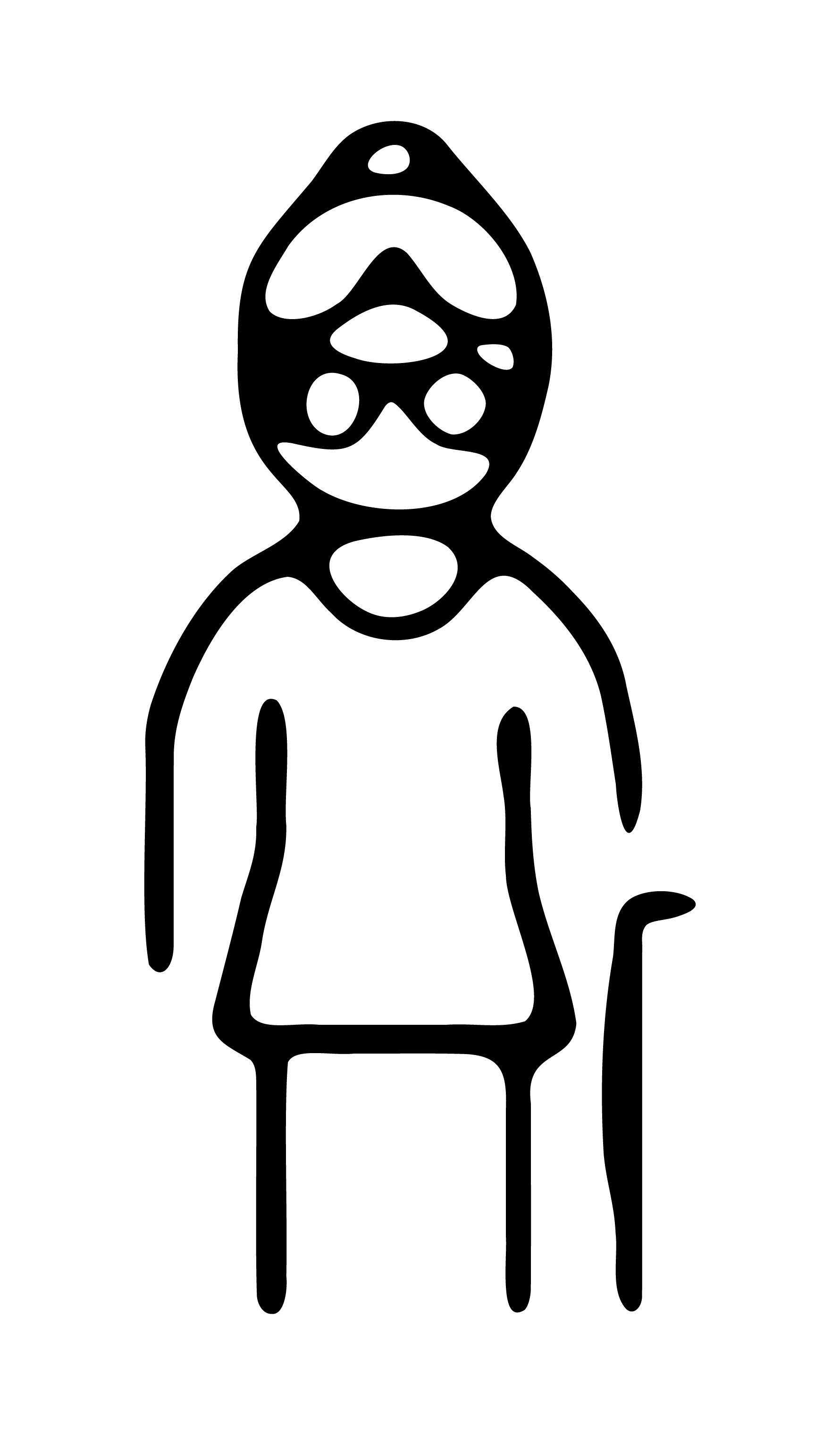 Illustration d'une cataracte